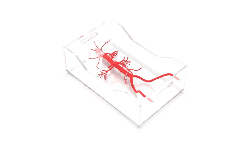 腹腔干模型解读腹腔干常见变异